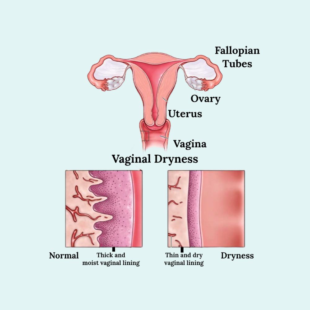vaginal moisture