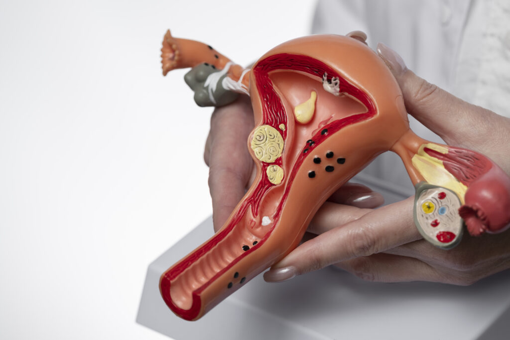 hand holding uterus ovary model