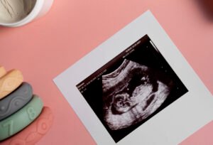 best IVF center in Kakinada