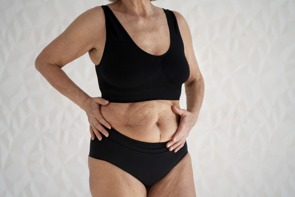 10 Tummy Tuck Recovery Tips 13 10 Tummy Tuck Recovery Tips