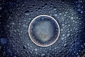 Blogs 10 IVF Best Hospital in Andhra Pradesh