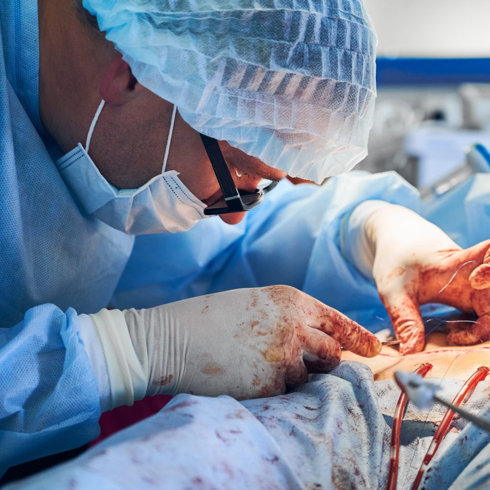 Close up of male surgeon in sterile gloves placing sutures after tummy tuck surgery. Man doctor wearing blue surgical uniform and medical mask, performing abdominal plastic surgery in operating room.